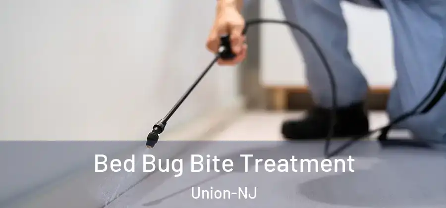 Bed Bug Bite Treatment Union-NJ
